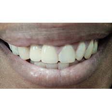 Detail of a man's mouth smiling
